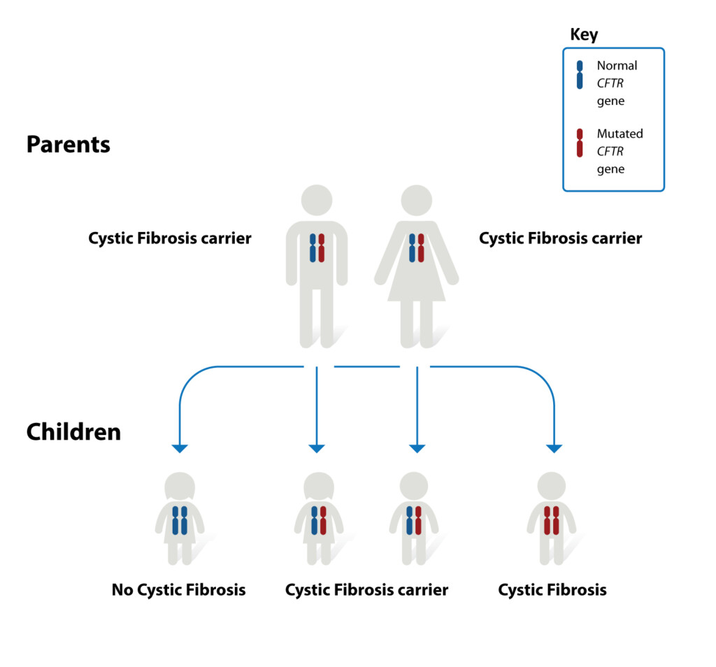 Cystic Fibrosis NHLBI NIH